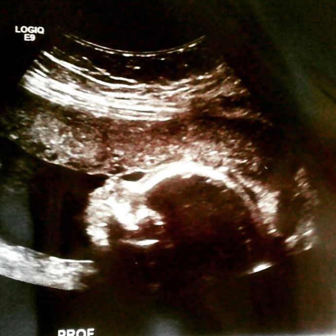 IMG_20170729_164320_473